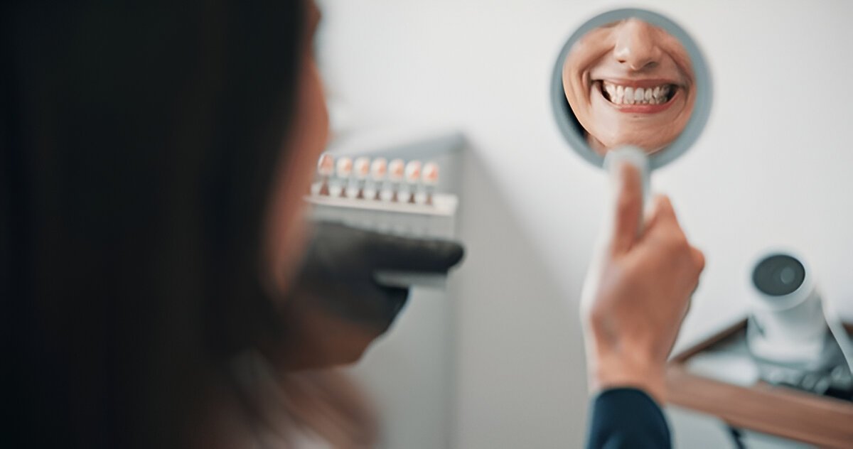 teeth whitening in marda loop
