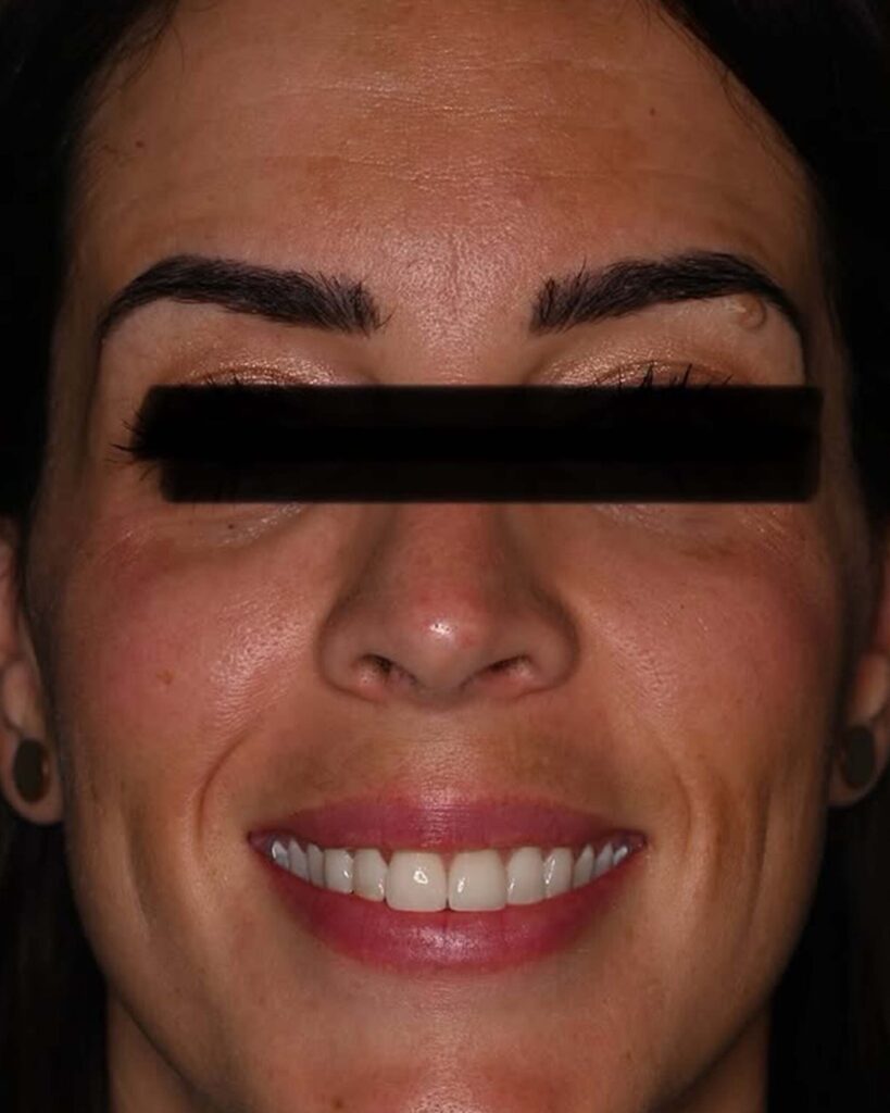 happy dental patient smile